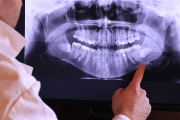 Best Emergency Root Canal Treatment in Kingston, PA