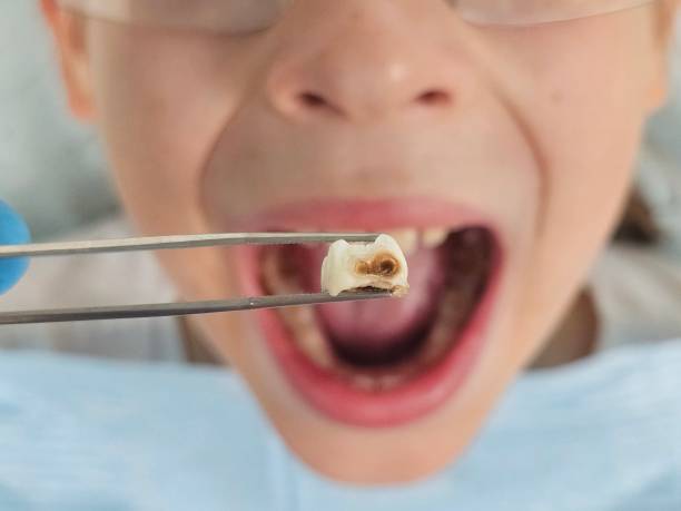 Best Cosmetic Emergency Dentistry in Kingston, PA
